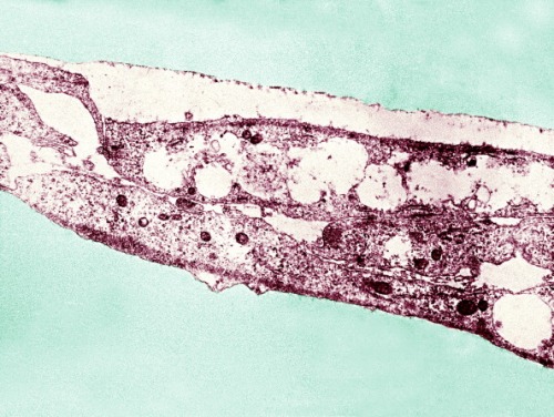 Syphilis Bacterium. Treponema Pallidum Subsp. Pallidum On Cultures Of Cotton Tail Rabbit Epithelium Cells Sf1Ep. Treponema Pallidum Is The Causative Agent Of Syphilis. In The United States Over 35 600 Cases Of Syphilis Were Reported By Health Officials In 1999. (Photo By BSIP/UIG Via Getty Images)